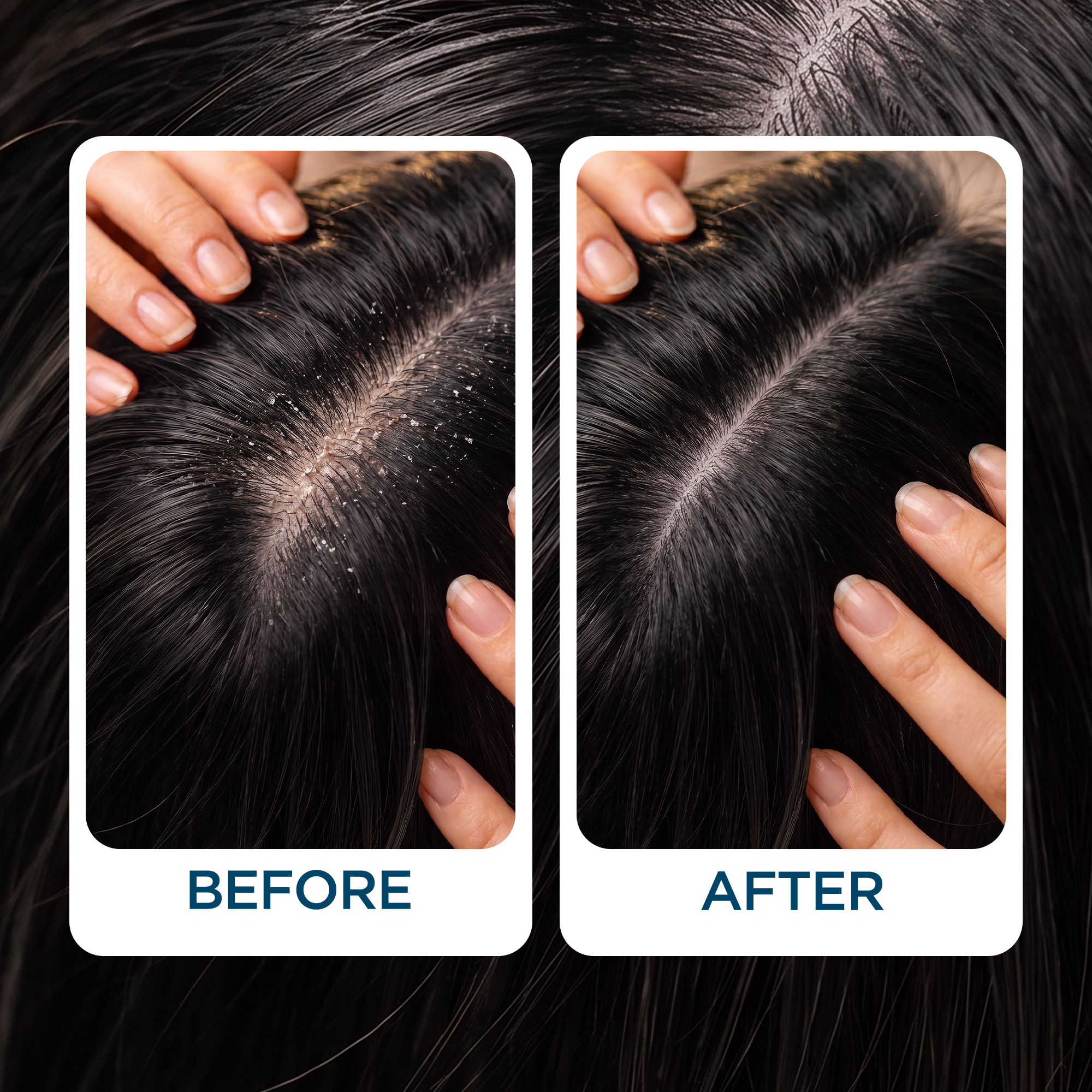 Bionii Hairstim-MBT Anti-Hairfall & Anti-Dandruff Shampoo with Keratin & Rosemary